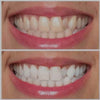 Ultra Violet Pearly Whites Brightening Gel - Maple Row Boutique 